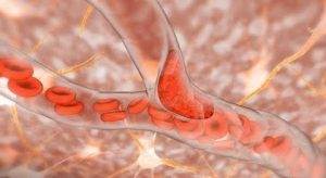 Beyin Kanamasına Hangi Bölüm Bakar ?