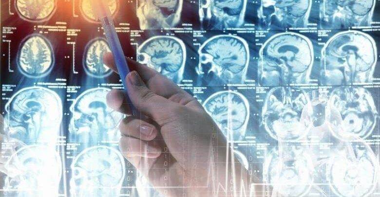 Beyin Tümörü Sebepleri Nelerdir ?