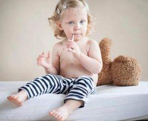 Su çiçeği nedir ?