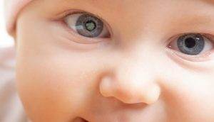 Ameliyattan sonra tekrar Katarakt oluşur mu ?