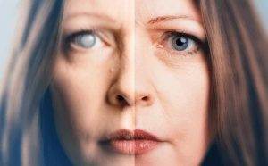 Katarakt nedir ? ve tedavi yöntemleri nelerdir ?