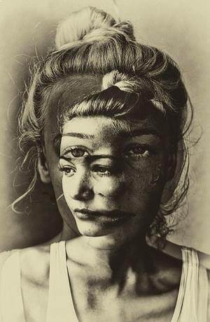 Renksiz tablo olarak sınıflandırılan şizofreni belirtileri