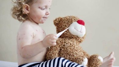 Çocuklarda Kızamık Hastalığı Nedir