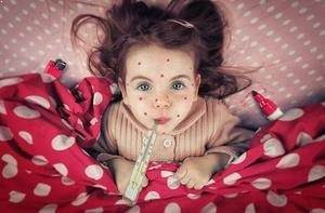 Kızamıkçık hastalığının tedavisi nelerdir