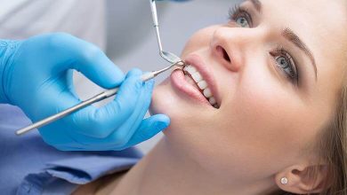 Diş Beyazlatma Yöntemleri Nelerdir