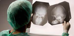 Hidrosefali Nasıl Teşhis Edilir