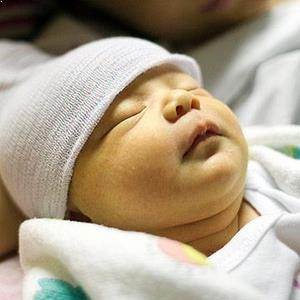 Yenidoğan Sarılığı Nedir? Belirtileri, Teşhisi ve Tedavisi