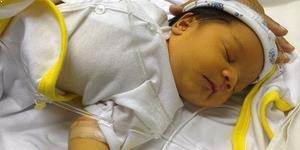 Yenidoğan Sarılığı Nedir