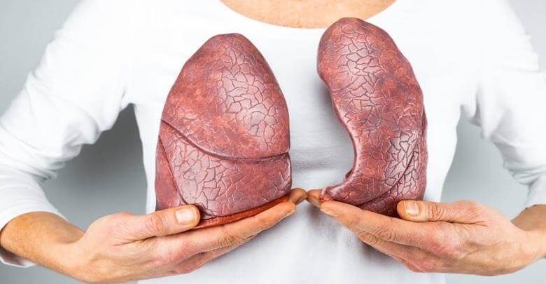 Akciğer Kanseri Nedir