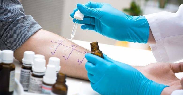 Alerji Testi Nasıl Yapılır