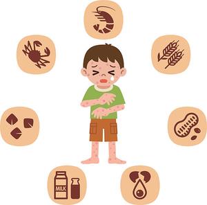 Anafilaktik Şok Nedir