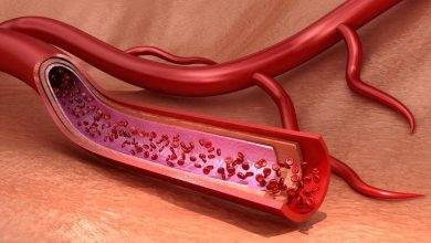 Hematoloji Tahlilleri