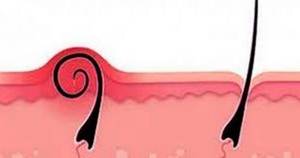 Kıl Dönmesi İçin Hangi Bölüme Gidilmelidir