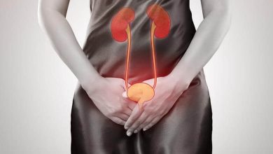 Mesane Kanseri Nedir