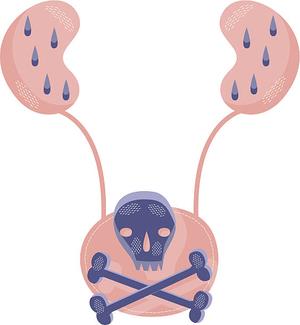 Mesane Kanseri Neden Olur