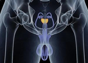 Prostat Kanseri Neden Olur