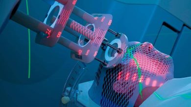 Görüntü Rehberliğinde Radyoterapi Nedir