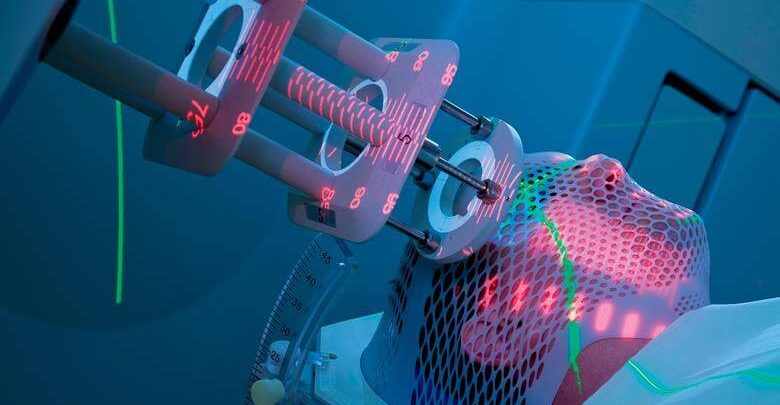 Görüntü Rehberliğinde Radyoterapi Nedir