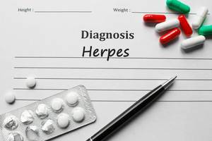Genital Herpes nasıl tedavi edilir