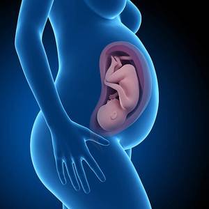 Hidrops Fetalis ile Doğum Nasıl Gerçekleştirilir