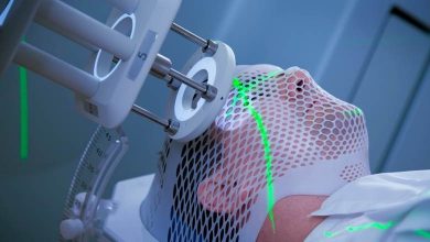 Işın tedavisi nedir