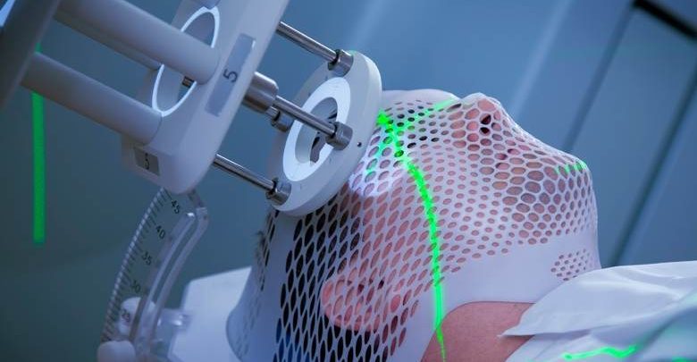 Işın tedavisi nedir