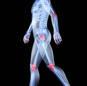 Reiter Sendromu Nedir