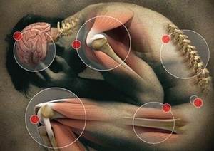 Reiter Sendromu (Reaktif Artrit) Nasıl Tedavi Edilir