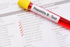 Hepatit B testi