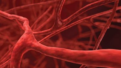 Behçet Hastalığı Nedir