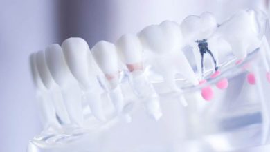 kanal tedavisi nedir