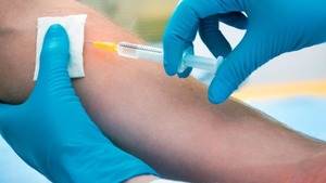 arı sokması tedavi