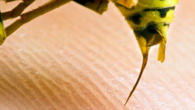 arı sokmasına ne iyi gelir