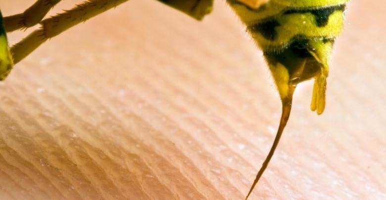 arı sokmasına ne iyi gelir