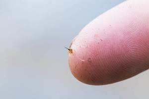 arı sokmasında ne yapılır