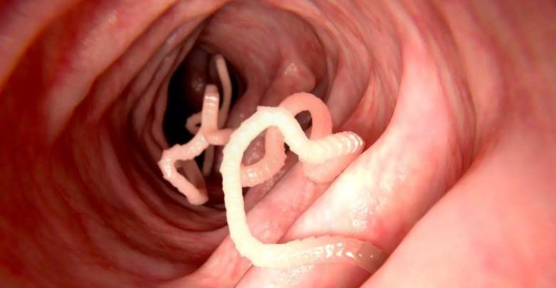 Bağırsak solucanı