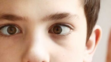 Şaşılık Nedir? Göz Kayması Neden Olur?