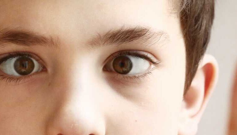 Şaşılık Nedir? Göz Kayması Neden Olur?