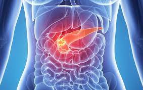 Akut Pankreatit Nedir?