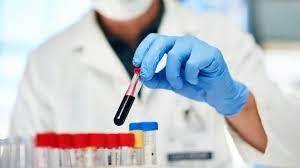 Kan gazı testi nedir? Kan gazı testi neden yapılır?