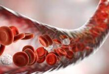 Hemofili Hastalığı Nedir?