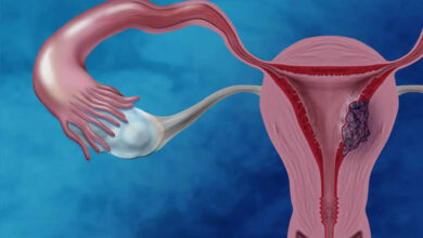 rahim kalınlaşması