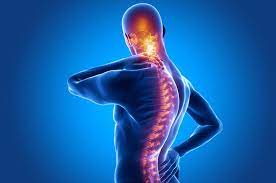 Ankilozan Spondilit Nedir?